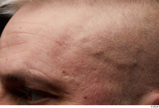  HD Face Skin Yury face forehead skin pores skin texture wrinkles 0001.jpg